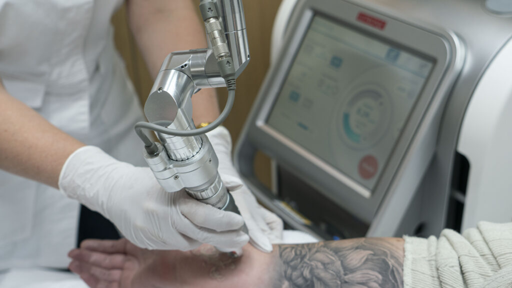 tattoo removal treatment with picopluslaser lutronic